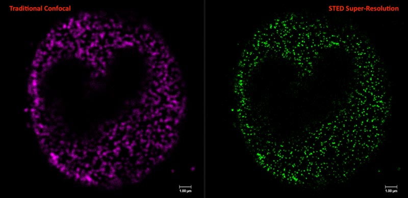 Images from the STELLARIS STED Super-Resolution Confocal Microscope