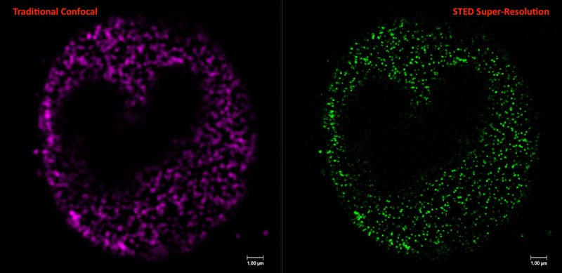 Images du microscope confocal super-résolution STELLARIS STED